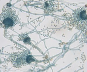 avimehrclinic-Aspergillus-fumigatus.jpg 