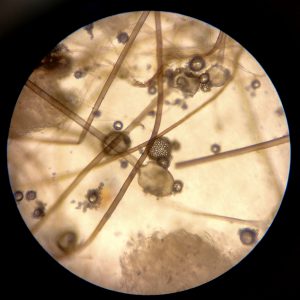 avimehrclinic-Mucor_sp-scaled.jpg
